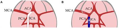 Updates on Selective Brain Hypothermia: Studies From Bench Work to Clinical Trials